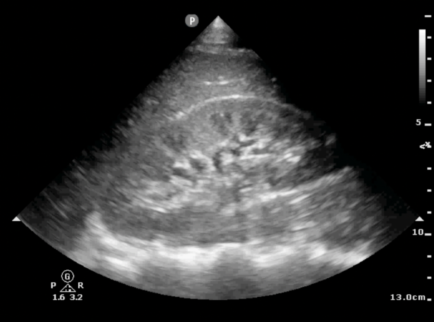 Scanning School - Renal — Taming the SRU